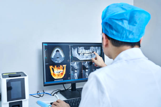 Best Emergency Dentist for Lost Fillings or Crowns in Newton, NJ