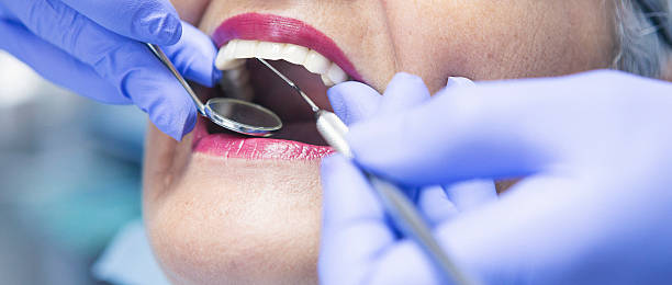 Best Broken or Cracked Tooth Emergency Dentist in Newton, NJ